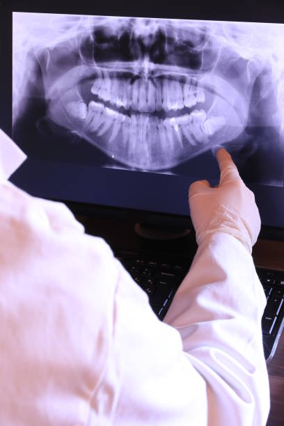 Best Emergency Root Canal Treatment in Greenville, OH